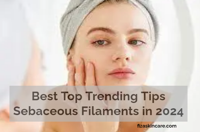 Sebaceous Filaments