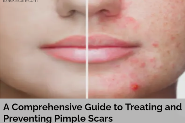 Pimple Scars