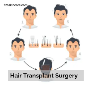 Hair Transplant Surgery